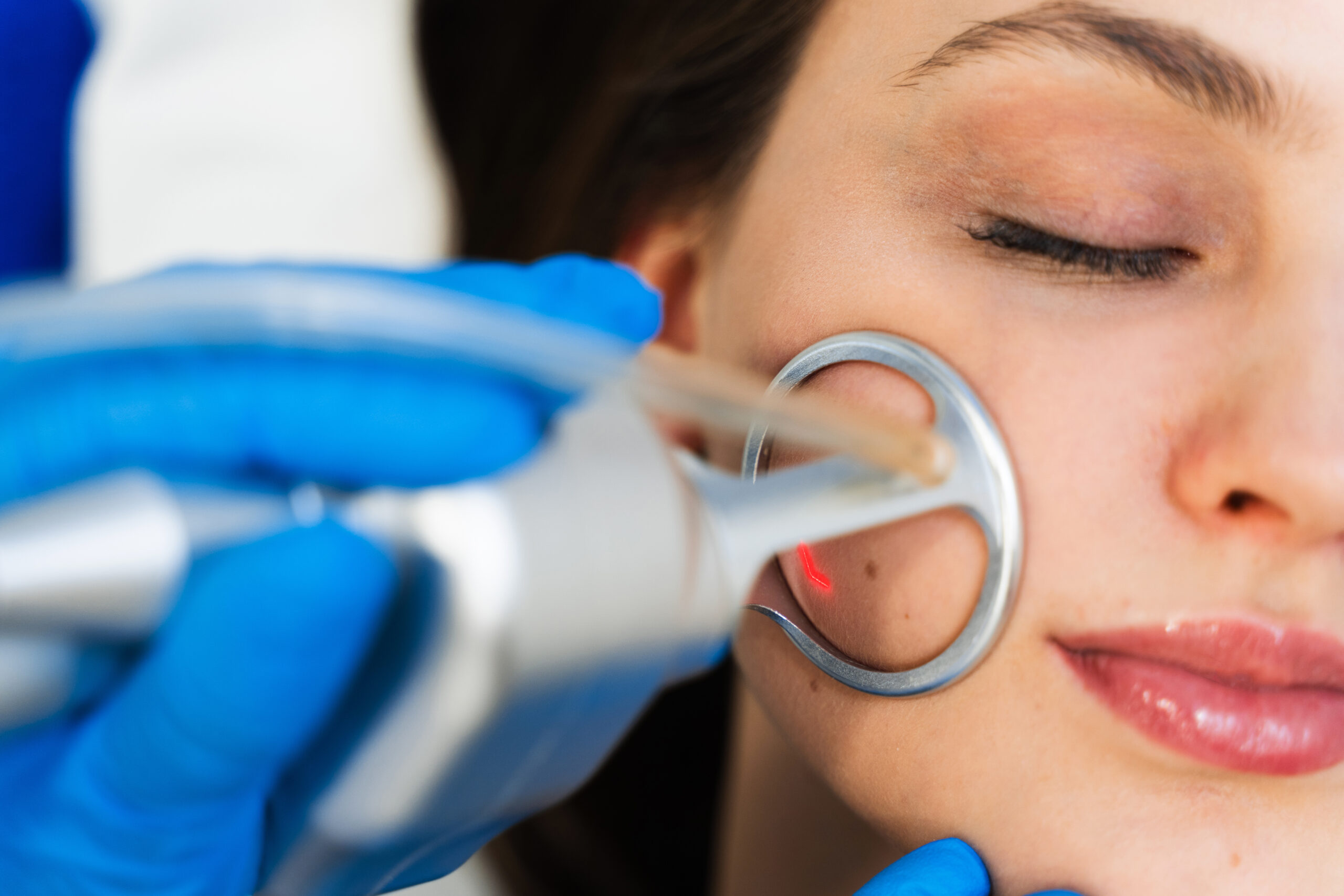 CO2-Laserbehandlung Ablauf in der Klinik am Schwarzwald