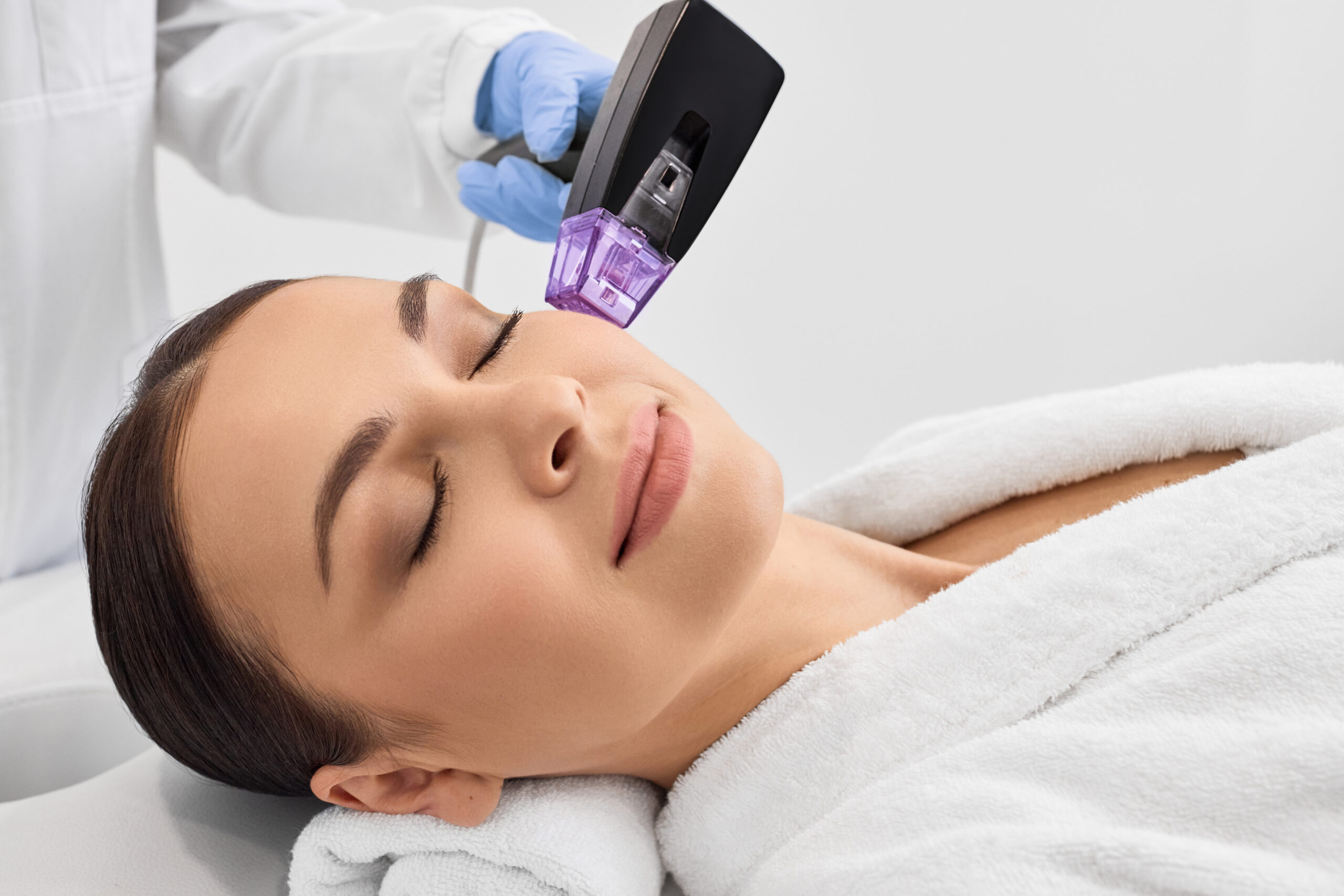 Radiofrequenz-Microneedling-Behandlung im Gesicht — Klinik am Schwarzwald