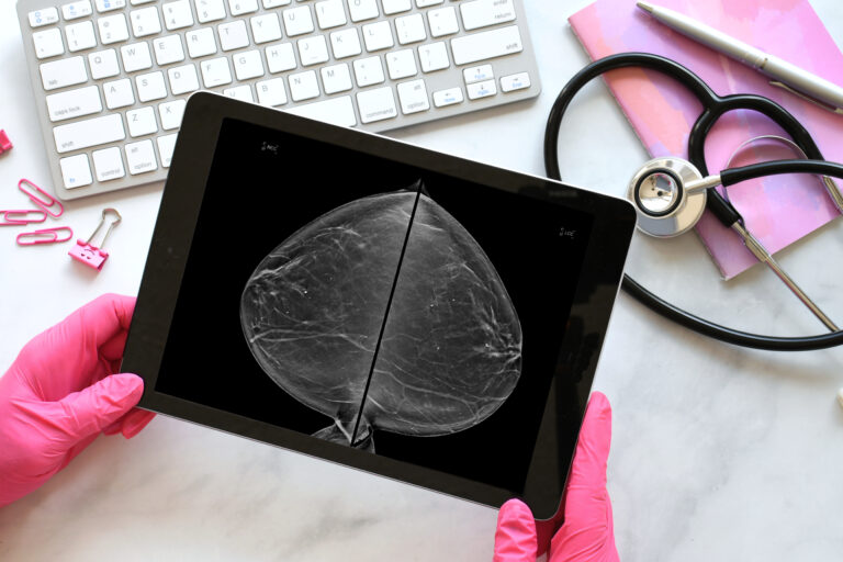 Tablet mit einer Mammographieaufnahme und medizinischen Handschuhen